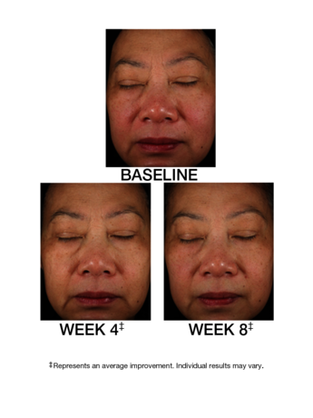 TimeWise Replenishing Serum C+E®