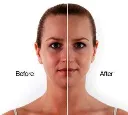 294509-mary-kay-esuite-cc-cream-before-after.webp