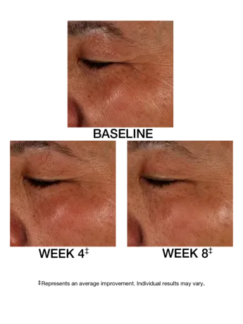 J2001771-DM-ES-Replen-C-PDP-10-26-20-Before-After-02.webp