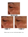 J2001771-DM-ES-Replen-C-PDP-10-26-20-Before-After-02.webp