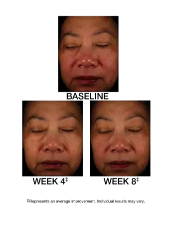 J2001771-DM-ES-Replen-C-PDP-10-26-20-Before-After-01.webp