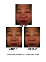 J2001771-DM-ES-Replen-C-PDP-10-26-20-Before-After-01.webp